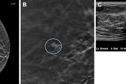 2024 09 17 Radiology Dbt