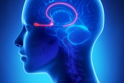 Olfactory Bulb Brain