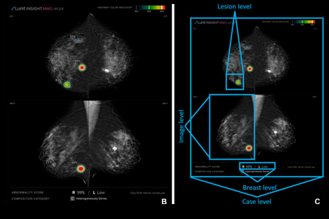 Images Large Radiol 232303 fig2 66ce302441dd2 Thumbnail