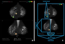 Images Large Radiol 232303 fig2 66ce302441dd2 Thumbnail