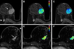 Images Large Radiol 240575 fig4 66d747ddc6c96