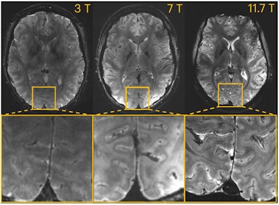 T2*-weighted 2D GRE axial images acquired at 3T, 7T, and 11.7T (different subjects). Acquisitions were performed with resolution = 0.2 × 0.2 × 1 mm3, FA = 27°, TE = 20 ms, TR = 0.6 s, bandwidth = 40 Hz/pixel, acquisition time = 4 min 20 s.