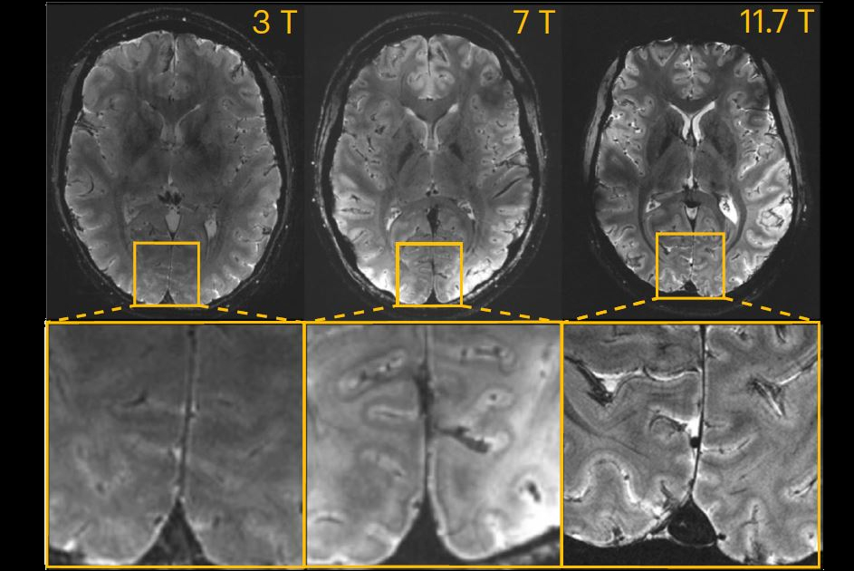 2024 10 21 11 7 Tesla Fig 3 Thumbnail