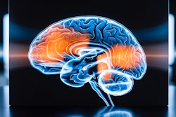 Brain2
