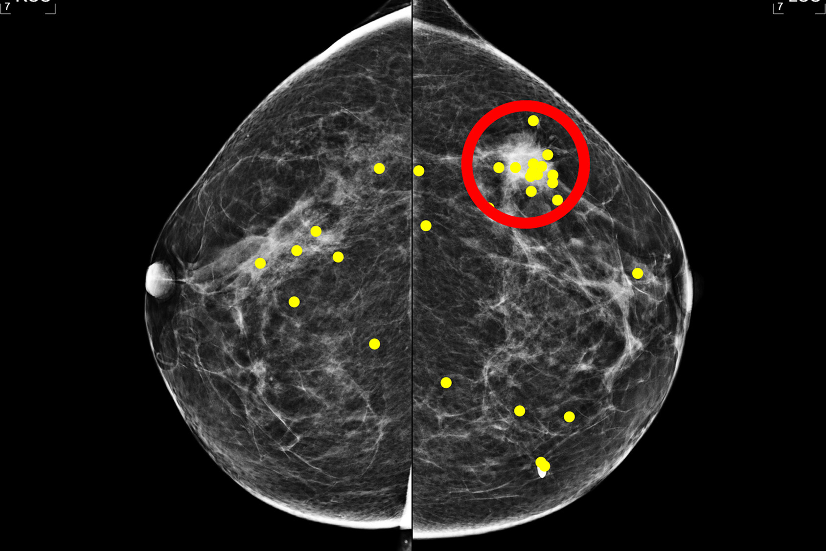 Images Large Radiol 240237 fig1 67056a35a0e37