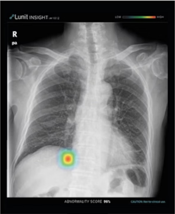 Lunit1 67097008bb4c9