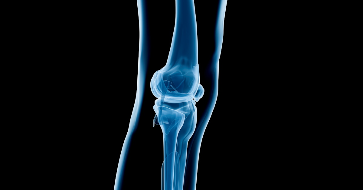 X Ray Knee Social