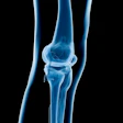 X Ray Knee Social