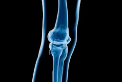 X Ray Knee Social