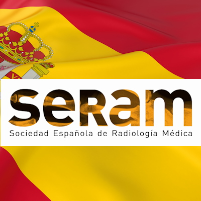 2023 02 13 Seram Spanish Flag