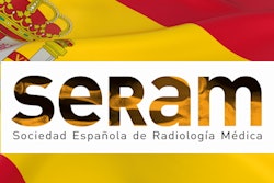 2023 02 13 Seram Spanish Flag