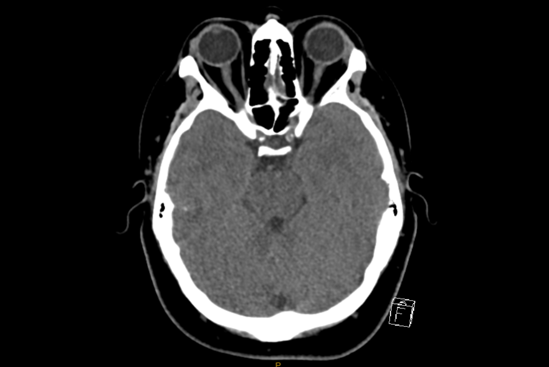 2024 11 07 Ct Insider Fig 2 Thumbnail