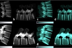 Dark Field Bone 672a6df2d7b85