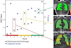 Mri Gas Exchange 6740efe22ea37