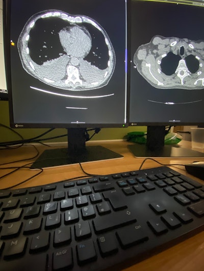 What most radiologists see: all day, every day. Image courtesy of Dr. Paul McCoubrie.