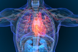 Heart Attack Disease 3 D