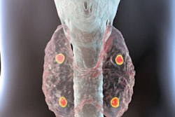 Hyperparathyroidism 6723cbda6242a