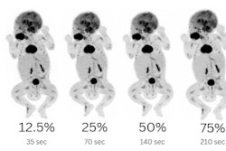 A significant cut in pediatric radiation dose is feasible in F-18 FDG long axial field-of-view PET/CT. Courtesy of the Nuclear Medicine and Molecular Imaging Department of the UMCG and EANM.