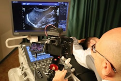 Ultrasound is an operator-dependent technique, the success of which rests on good training. All figures courtesy of Dr. Pasquale Maria Parrella et al and ESR EPOS database.