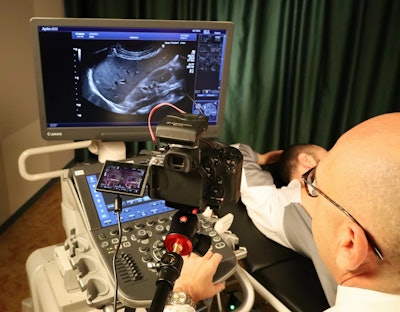 Ultrasound is an operator-dependent technique, the success of which rests on good training. All figures courtesy of Dr. Pasquale Maria Parrella et al and ESR EPOS database.