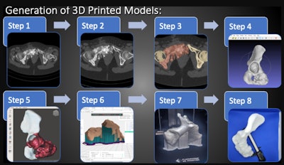 Sequential steps involved in the generation of 3D printed models. Step 1: Selection of CT and MRI studies. Step 2: Radiologist's analysis and fusion of CT and MRI modalities. Step 3: Segmentation using 3D Slicer. Step 4: Refinement with MeshLab. Step 5: Preparation and editing with Meshmixer. Step 6: 3D printing preparation with FlashPrint. Step 7: 3D printing using FDM Printer and PLA material. Step 8: Measurement with millimetric caliper. Courtesy of Dr. Pedro Zapata et al and ESR EPOS database.