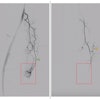 Digital Subtraction Angiography Dsa Gae 673f5b7c2c15d