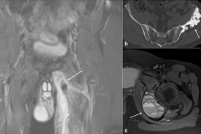 2025 01 06 Botchu 3 Thumbnail