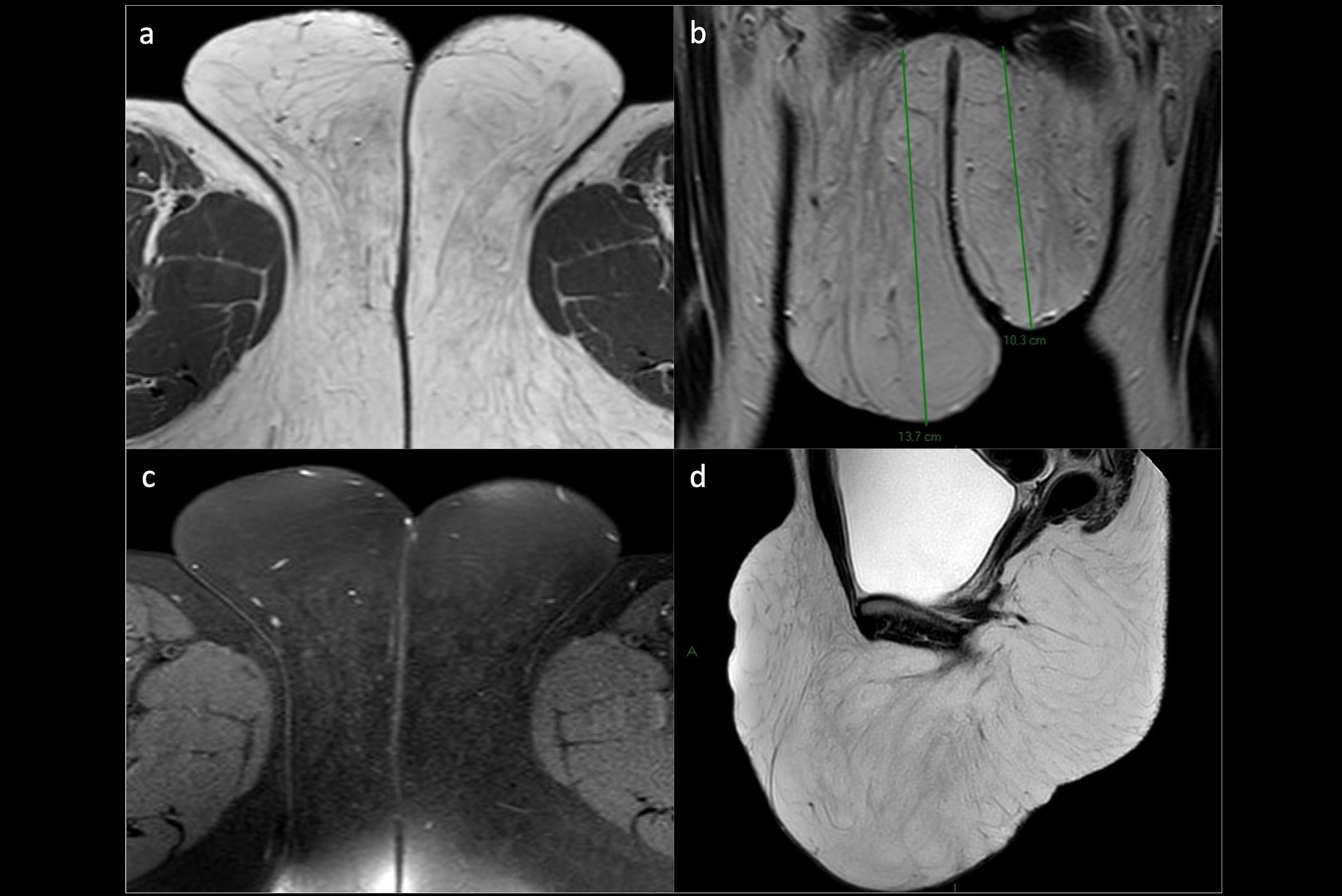 2025 01 16 Mri Insider Figure 8 Thumbnail