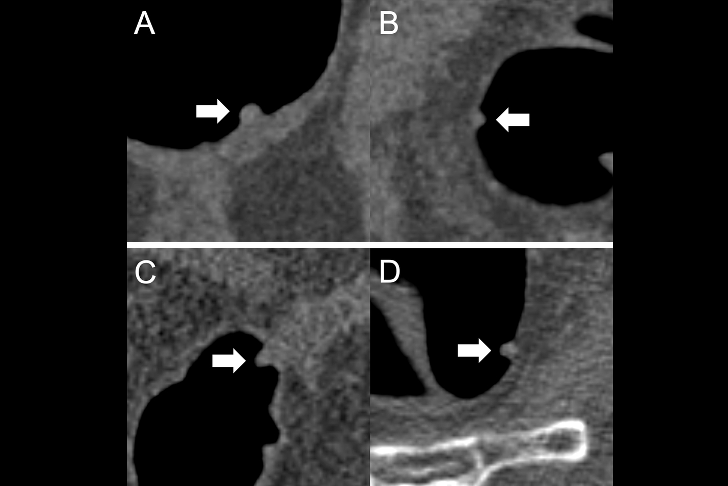 2025 01 30 Ct Insider Fig1 Thumbnail
