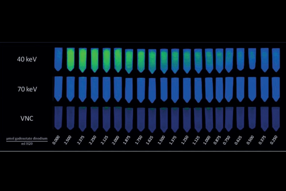 2025 02 06 Thumbnail Image Of Gadoxetate Disodium Dilution Series From Custom Phantom Thumbnail