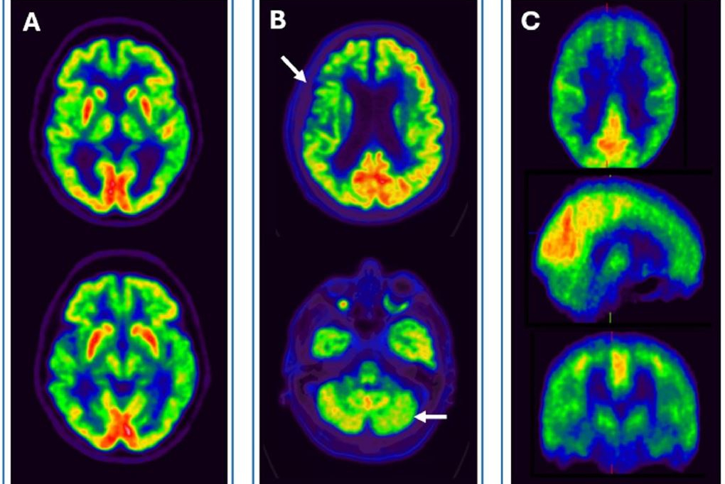 2025 02 13 Mol Insider Figure 5 Thumbnail