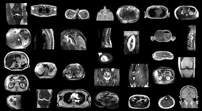 Example MRI scans in the training dataset. Since images were randomly sampled from clinical routine, the dataset contains a wide variety of different contrasts, pathologies, and image types. Images and caption courtesy of the RSNA.