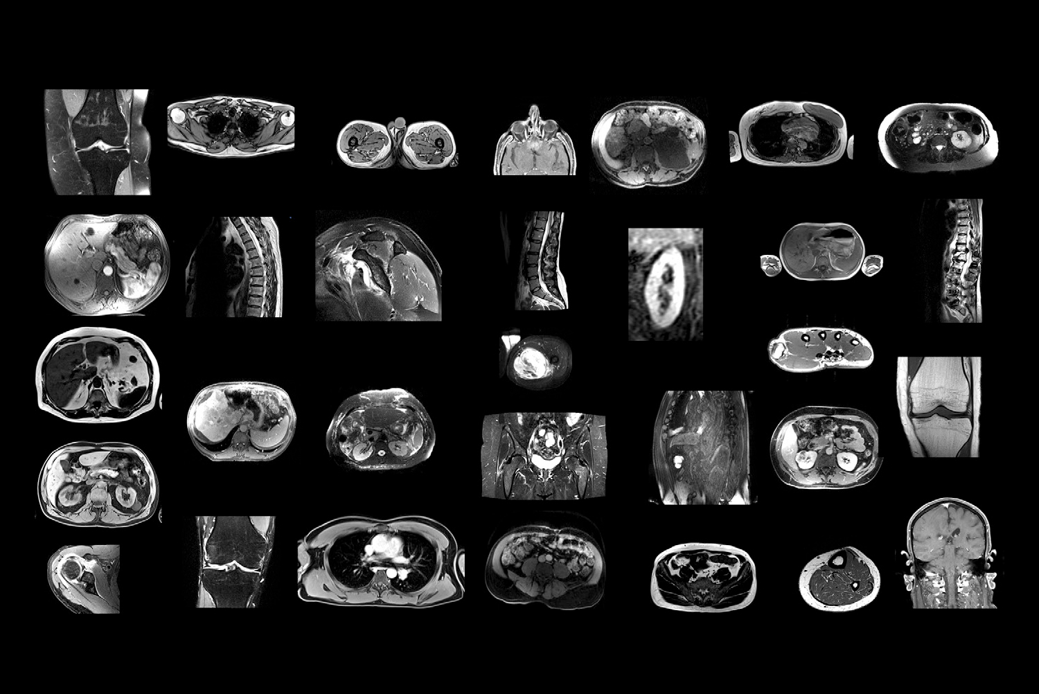 2025 02 18 Radiology D Antonoli Figure1 Thumbnail 67afcfff1077f