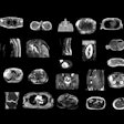 2025 02 18 Radiology D Antonoli Figure1 Thumbnail 67afcfff1077f