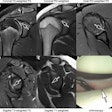 Fast Mri 67b4d940e3fff