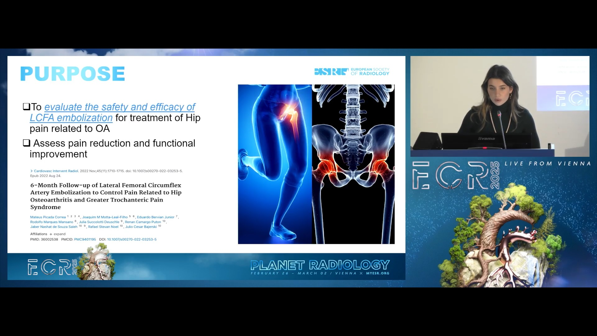 Hip Embolization 67c21713cc449
