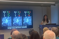Sarah Verboom presents her team's research at ECR 2025, showing that AI's performance is affected by mammographic image quality more than radiologists.