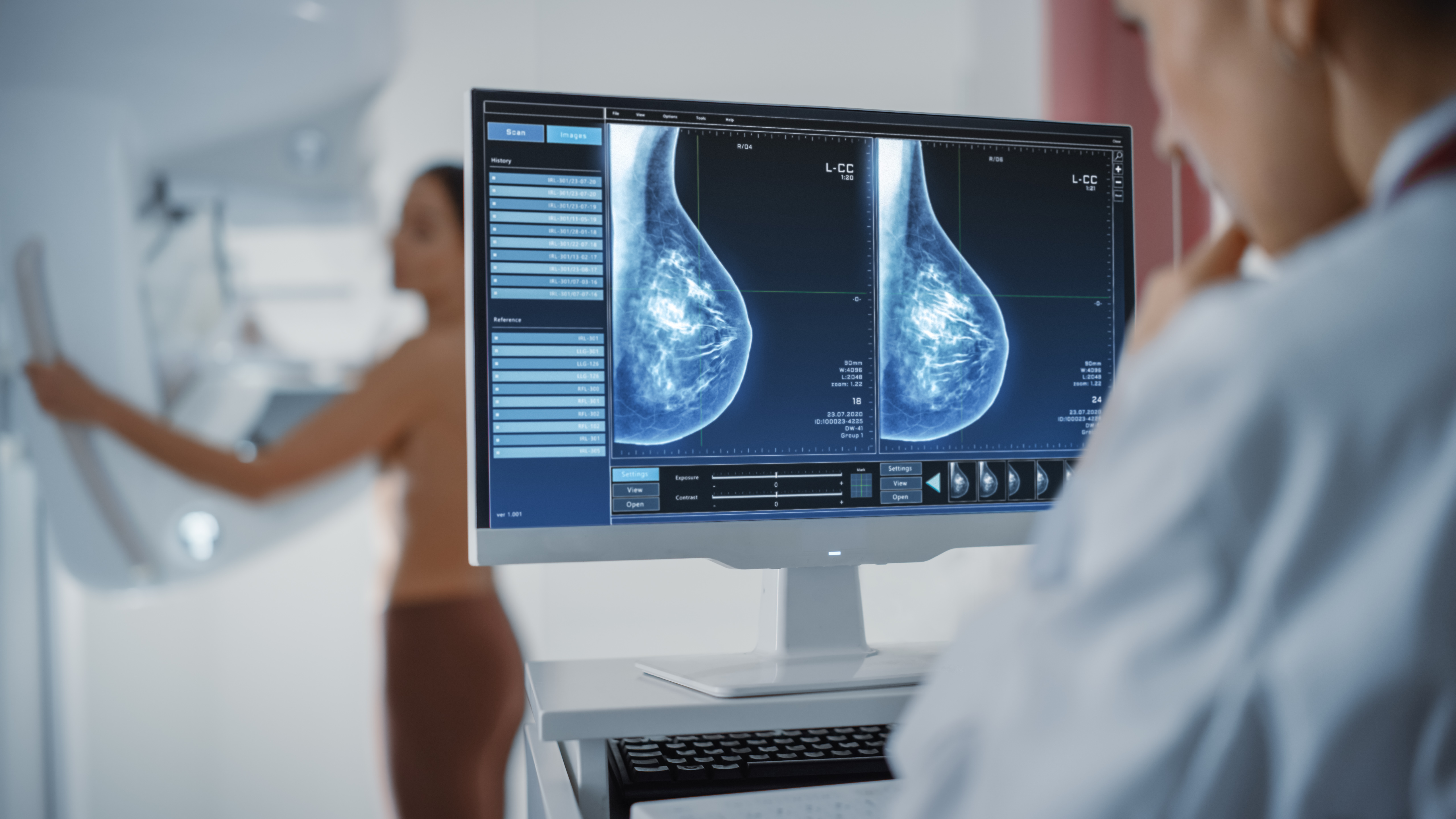 Mammogram Dense Breasts