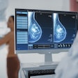 Mammogram Dense Breasts