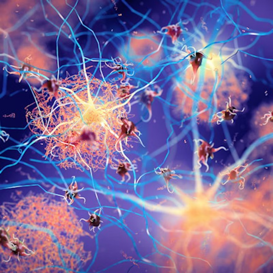 Amyloid 6793e04aba876