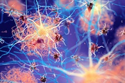 Amyloid 6793e04aba876