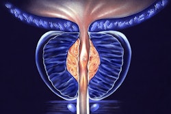 Benign Prostatic Hyperplasia