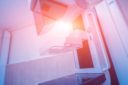 Breast Mammography Scanner 400
