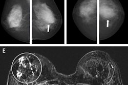 Images Large Radiol 233067 fig4 67a25d14e42fc