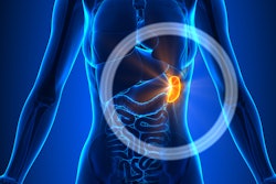 Spleen2