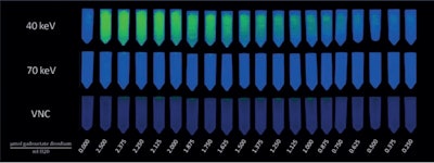 Image of gadoxetate disodium dilution series from custom phantom with 40-keV VMI, 70-keV VMI, and VNC reconstructions, obtained using photon-counting detector CT. VMI = virtual monoenergetic image, VNC=virtual noncontrast. Image and caption courtesy of the AJR.