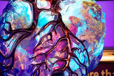 Vendors emphasized new advances in cardiac imaging at ECR 2025.