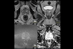 2025 03 13 Prostate Ai Radiologist Interactions Slide4 Thumbnail