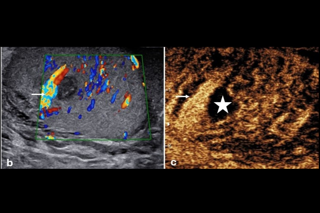 2025 03 27 Ultrasound Insider Fig 5 Thumbnail