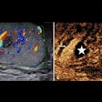 2025 03 27 Ultrasound Insider Fig 5 Thumbnail